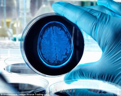 افزایش سرعت مبتلا شدن به زوال عقل در جهان